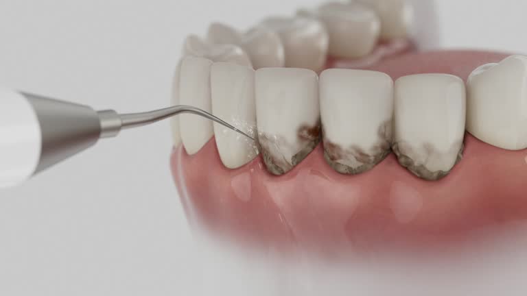 Trusted Root Canal Treatment service in Mona, UT - Dentist Open Now